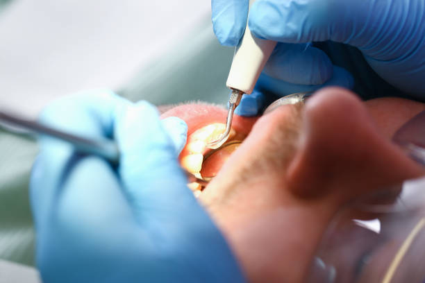 Best Mobile Emergency Dentist in Dallas, GA